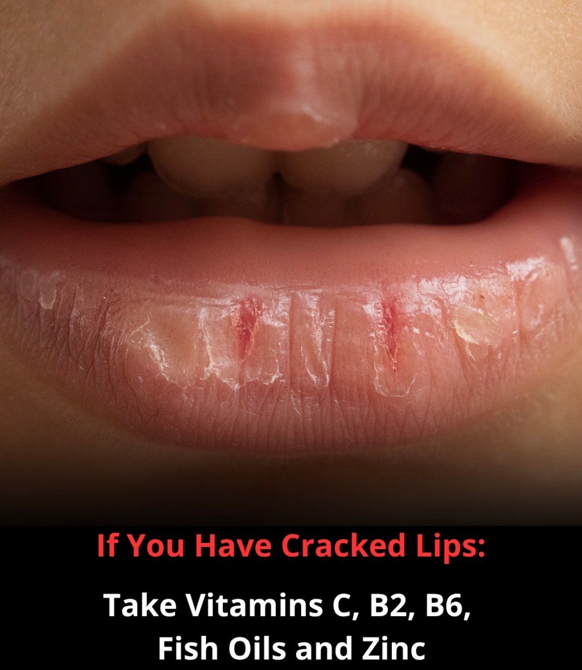 Dry Skin Protocol